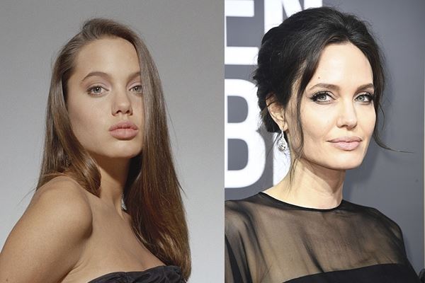 Как у звезды: сколько стоят скулы Анджелины Джоли?